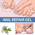 thumbnail image 3 of 3pcs Anti-Fungal Nail Treatment Gel Nail Care Gel Nail Thickening Brightening Onychomycosis Repair Cream, 3 of 5