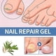 thumbnail image 3 of 3pcs Anti-Fungal Nail Treatment Gel Nail Care Gel Nail Thickening Brightening Onychomycosis Repair Cream, 3 of 5