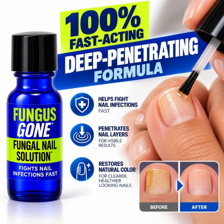 Nail-Aid Fungus Gone Maximum Strength Serum photo 6