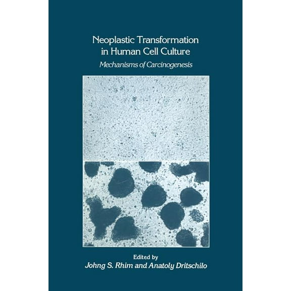 Experimental Biology and Medicine Neoplastic Transformation in Human Cell Culture: Mechanisms of Carcinogenesis, Book 25, (Paperback)