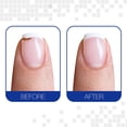 thumbnail image 4 of Kit de Reparación de Uñas Nail Tek Gel en Pincel, 4 of 6