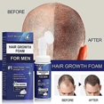 thumbnail image 2 of Men's hair foam deep cleansing, moisturizing and care for hair roots and, 2 of 5
