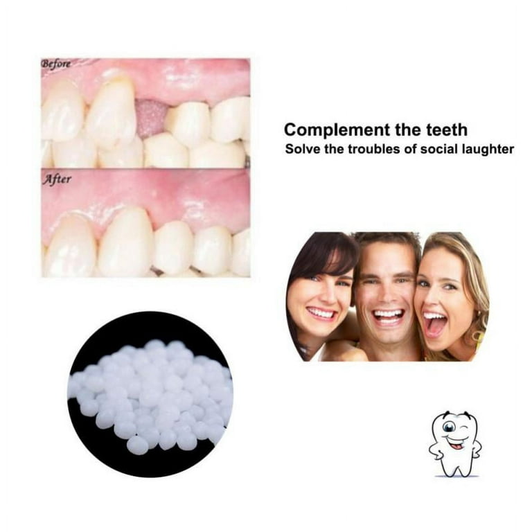 Tooth Repair Kit-Thermal Beads For Filling Fix The Missing And Broken Tooth  Or Adhesive The Denture Fake Teeth Veneer 50g/100g Moldable False Teeth for  Snap On Instant and Confident Smile 