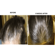 The Mane Choice Manetabolism Plus Healthy Hair Growth Vitamins 60 Capsules Pack Of