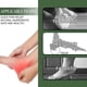 thumbnail image 4 of Heel Pain Spray Heel Pain Relieve Pain Soles Soles Bones Bones Bone Pain Achilles Tendon, 4 of 4