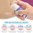 thumbnail image 5 of Vogisg Silicone Scar Gel and Scar Cream (2-PCS Set),Deep Hydrate and Soften, New and Old Scar Removal, 5 of 10