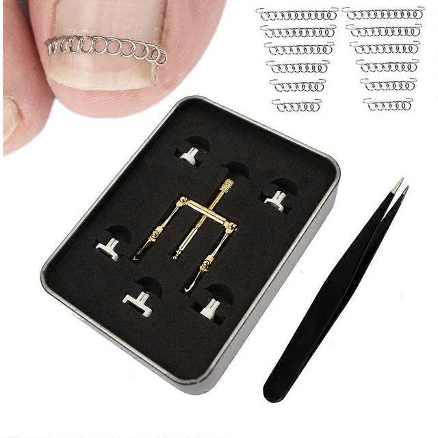 Kit de tratamiento para uñas encarnadas Corrector de paroniquia Corrector de uñas encarnadas