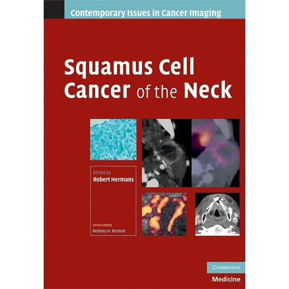 Contemporary Issues in Cancer Imaging Squamous Cell Cancer of the Neck, (Hardcover)