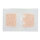 thumbnail image 2 of Cinta Adhesiva Para Cierre De Heridas, Parche Para Heridas Con Puntada De Cremallera, Diseño De Hebilla De Tela No Tejida Para El Hogar Y La Oficina Al Aire Libre, 2 of 7