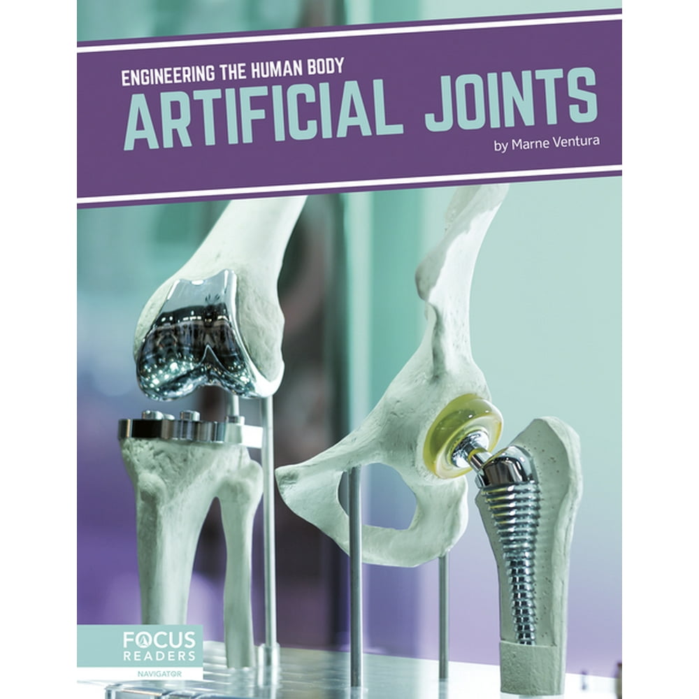 Artificial Joints (Hardcover)