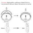 thumbnail image 3 of Pectus Carinatum Orthosis Brace, Adjustable Pigeon Chest Brace, Ribs Valgus Orthosis Support for Chid, 3 of 9