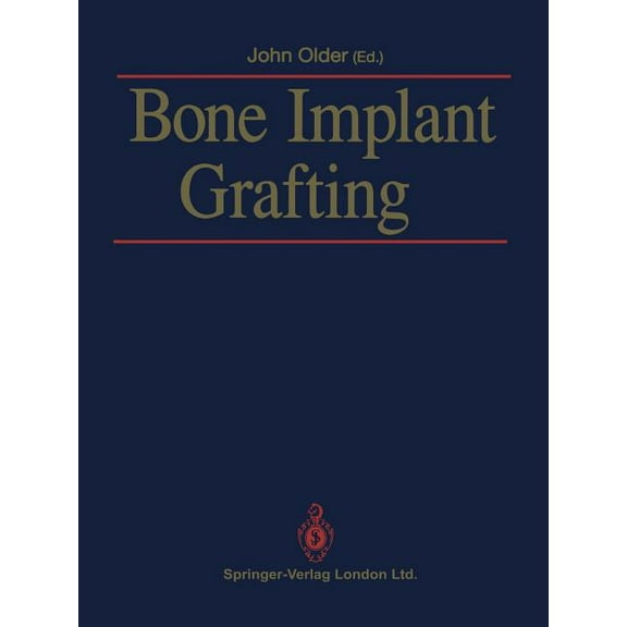 Bone Implant Grafting, (Paperback)
