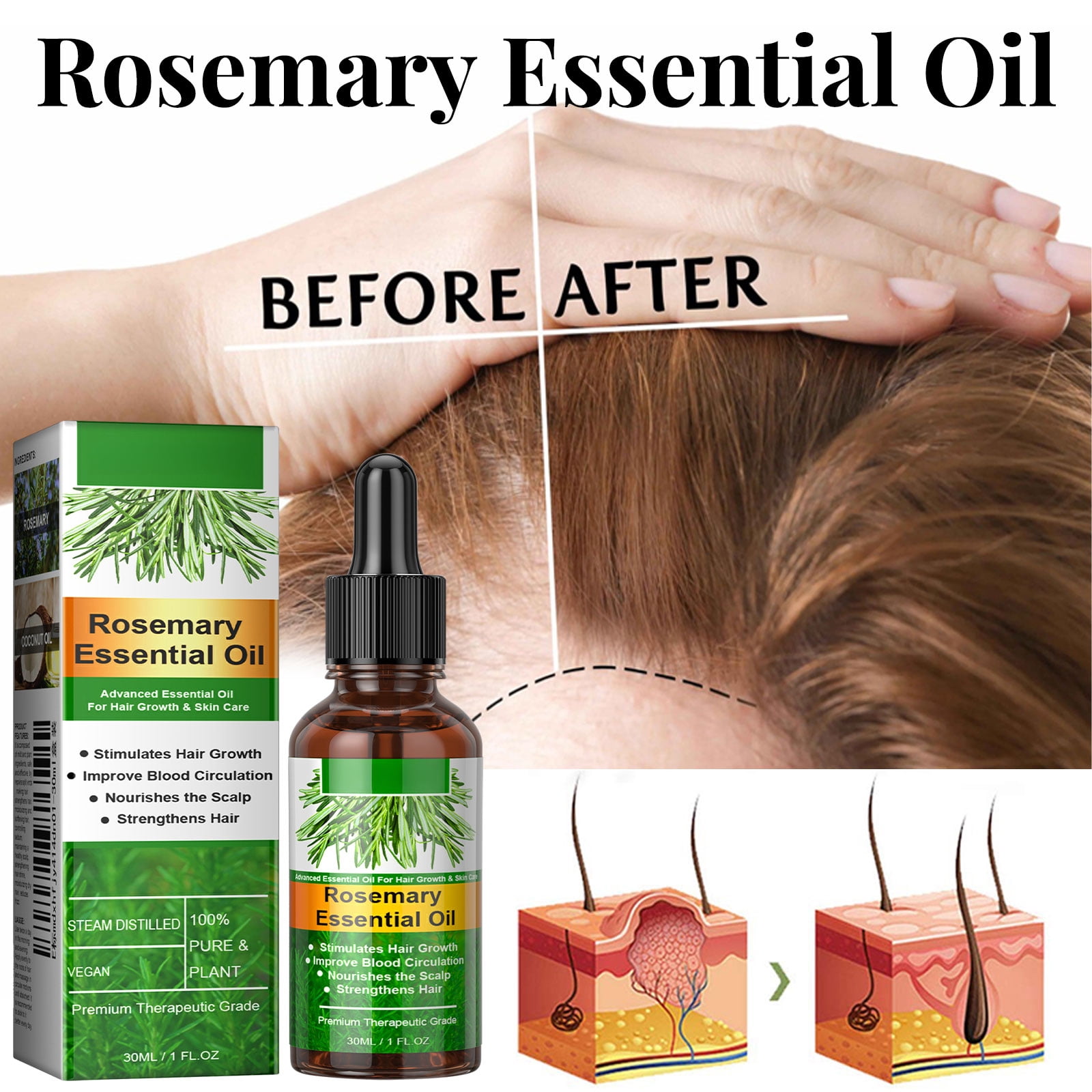 Alvantor Nourishing Hair Oil with Rosemary and Castor for Dry Scalp, 1.01 fl. oz