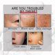 thumbnail image 3 of Collagen Anti-wrinkle Cream Collagen Reorganization Restores Fine Lines M, 3 of 4