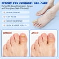 thumbnail image 3 of Easygou Fungal Nail Patches, 2026 New Fungal Nail Treatment Patches, Nail Repair Patches,Multi-Purpose Toenail Repair Treatment Pads,Toenail Patches, Antifungal Nail Treatment, 3 of 8
