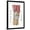 Black Frame, variant on Art.com Anatomy of Human Knee Joint Art Print, 12" x 18"