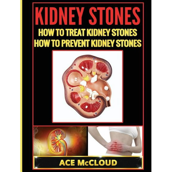 Kidney Stone Treatment & Prevention Kidney Stones: How To Treat Kidney Stones: How To Prevent Kidney Stones, (Hardcover)