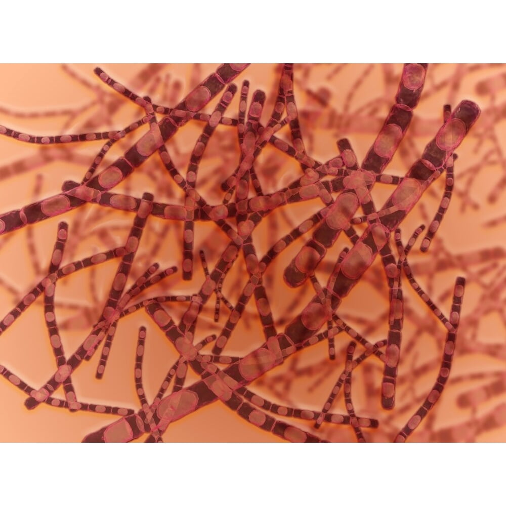 Microscopic view of Anthrax. Anthrax is an acute disease caused by the ...