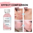 thumbnail image 3 of Fiudx Loción Corporal, Crema Exfoliante Suave para La Piel, Fórmula Hidratante con Ceramidas, Cuidado para Piel Seca y Áspera, Humectante de Uso Diario, Apto para Piel Sensible, Aprobado Por Dermatól, 3 of 7