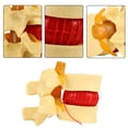 thumbnail image 3 of 1:1.5 Anatomical  Human Lumbar Degenerative Lumbar Disc Herniation Demonstration Model Human Spine, 3 of 8