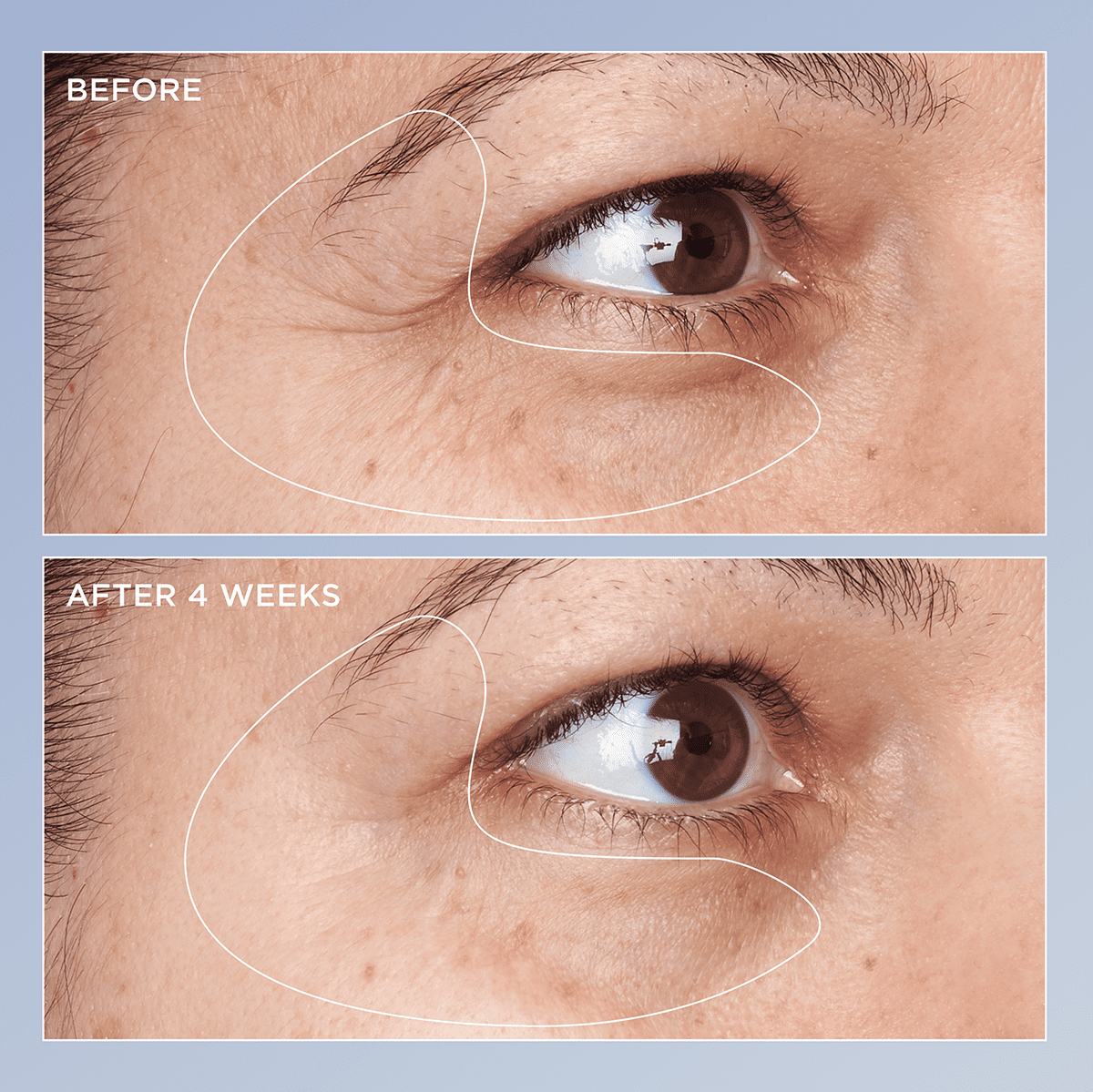 High Potency Triple Retinol Renewal Eye Serum