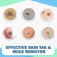 thumbnail image 3 of Limpie las etiquetas Moles Remover 3ml Skin Tags Mole Remover Fórmula efectiva para la eliminación de etiquetas de piel, kaili Sencillez, 3 of 4