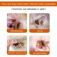 thumbnail image 3 of Gently Clean & Deodorize Your Pet's Ears with 60pcs Anti-Odor Ear Mite Wipes!, 3 of 4