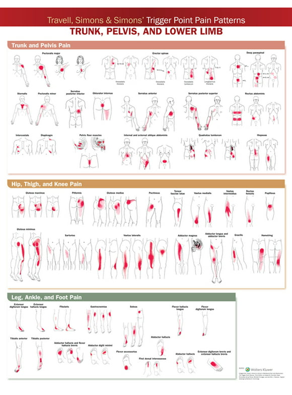 Travell, Simons & Simons' Trigger Point Pain Patterns Wall Chart: Trunk, Pelvis, and Lower Limb (Other)