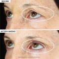 thumbnail image 2 of StriVectin Peptight 360˚ Tightening Eye Serum, 1 fl. Oz, 2 of 8