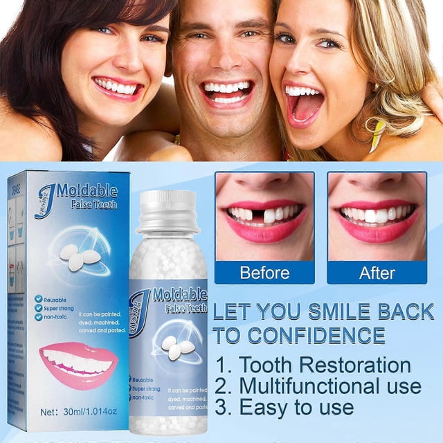 paquetes de 30 g de pegamento sólido para dentaduras postizas, maquillaje para cine y televisión, pegamento sólido para dentaduras postizas, empastes dentales temporales, pegamento dental