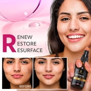 InstaSkincare Retinol Renewing Face Serum, Reduce Wrinkles & Anti-Aging, with Hyaluronic Acid, 2 oz
