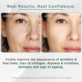 thumbnail image 5 of Retinol+Hyaluronic Serum for Hydration, Radiance, Hyperpigmentation, Blemishes, Skin Texture - 30ml/f1 oz, 5 of 10