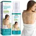 thumbnail image 1 of Fiudx Ofertas y liquidaciones Cura para la espalda, cura corporal contaminante salicílico y aceite de té, cura a base en adolescentes, solución para la espalda 120ML, 1 of 7