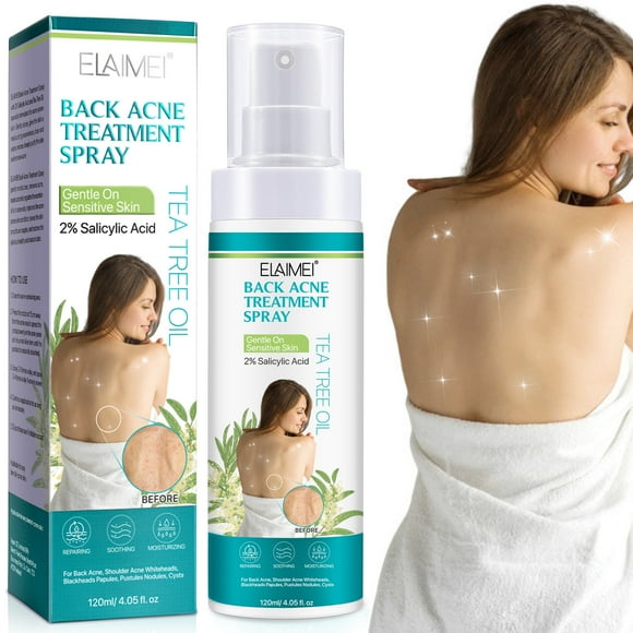 Bilqis Back Cure, Body Cure With SalicylicAcid And Tea TreeOil, Herbal Component Cure For Teens, Back Solution 120ML