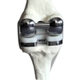 thumbnail image 3 of Knee Joint Model Simulation Replacement Surgery Meniscus Ligament Cartilages Model,Artificial, 3 of 6