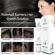 thumbnail image 4 of Fiudx Tratamiento de Aceite Herbal, Rodillo Nutritivo para El Cuero Cabelludo, Solución Portátil para El Cuidado Del Cabello, Fortalece Los Folículos Pilosos, Mejora El Brillo y La Fuerza, Diseño Ide, 4 of 6