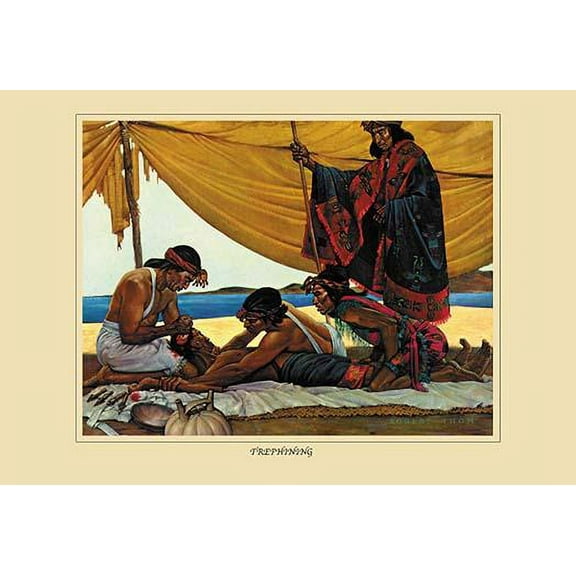 Trephining- Fine Art Canvas Print (20" x 30")