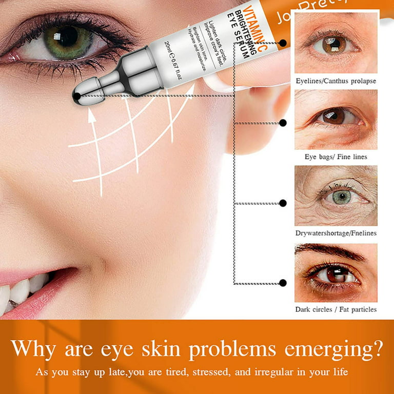 Can I Use Vitamin C Around My Eyes?