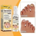 thumbnail image 2 of Bee Venom Nail Treatment Solution, Bee Venom Nail Fungus Treatment, Extra Strength Nail Repair Solution, Nail Fungus Care Spray, 2 of 5