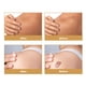 thumbnail image 4 of Hojas de cicatrices cinta de cicatriz de silicona recortable impermeable autoadhesiva para todo el cuerpo ANGGREK Otros, 4 of 8