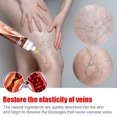 thumbnail image 4 of Crema para el alivio de las venas varicosas Crema antivaricosa de 20g para aliviar la terapia de los vasos sanguíneos de araña, loción reafirmante para venas, 4 of 6