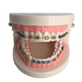 thumbnail image 2 of Modelo Avanzado de Ortodoncia con Soportes Metálicos Duraderos, 2 of 5