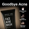 thumbnail image 3 of Kit Shield Acne System de 3 pasos con peróxido de benzoilo al 4%, 3 of 9
