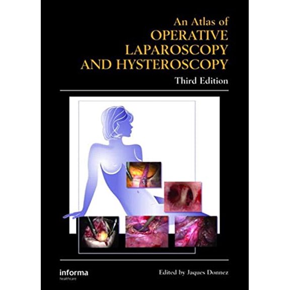 Pre-Owned Atlas of Operative Laparoscopy and Hysteroscopy (Encyclopedia of Visual Medicine Series), 9780415384155, 041538415X, Hardcover, 3rd edition