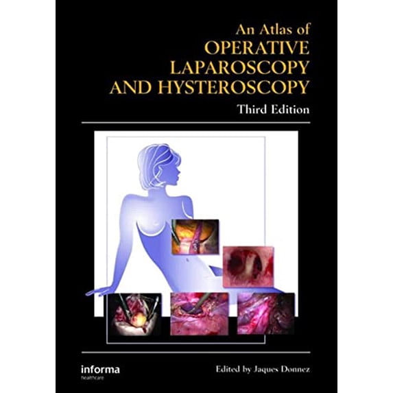 Pre-Owned Atlas of Operative Laparoscopy and Hysteroscopy (Encyclopedia of Visual Medicine Series), 9780415384155, 041538415X, Hardcover, 3rd edition