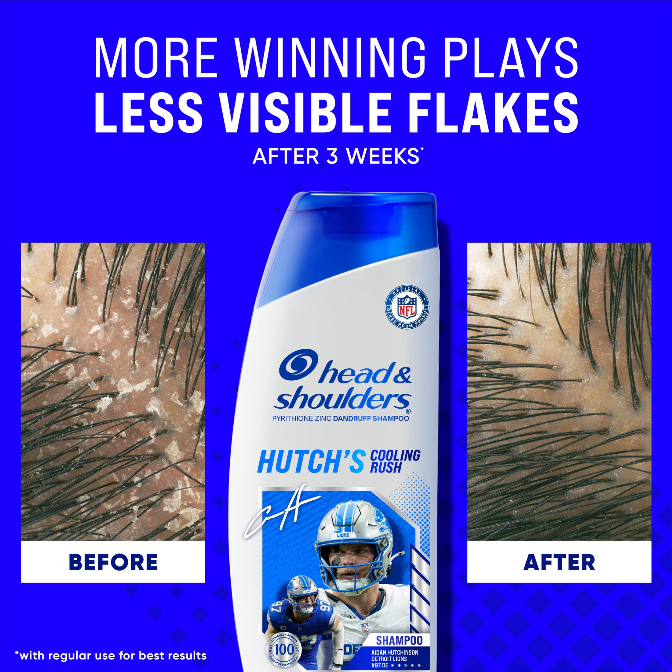 Head and Shoulders Dandruff Mens Shampoo, Hutch's Cooling Rush, NFL Collection, 12.5 fl oz