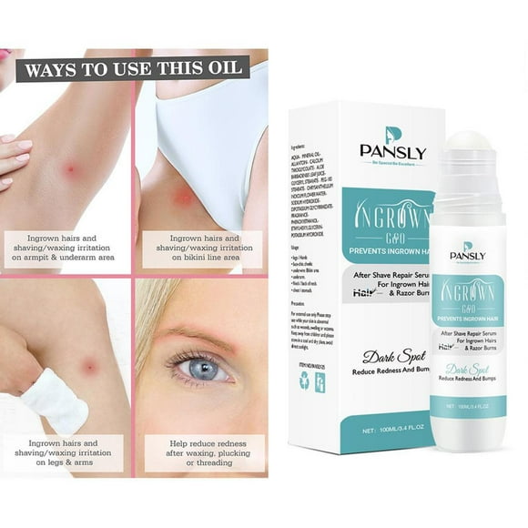 Suero Para Después Del Afeitado De 100 Ml Para Hombres Y Mujeres, Removedor De Yinane tratamiento de pelo encarnado