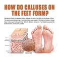 thumbnail image 4 of OUHOE Foot Exfoliating Spray Repair Heel Calluses Dead Skin Anti-chapped Moisturizing Foot Care, 4 of 5