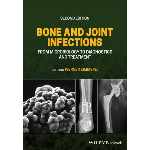 Bone and Joint Infections: From Microbiology to Diagnostics and Treatment (Hardcover)