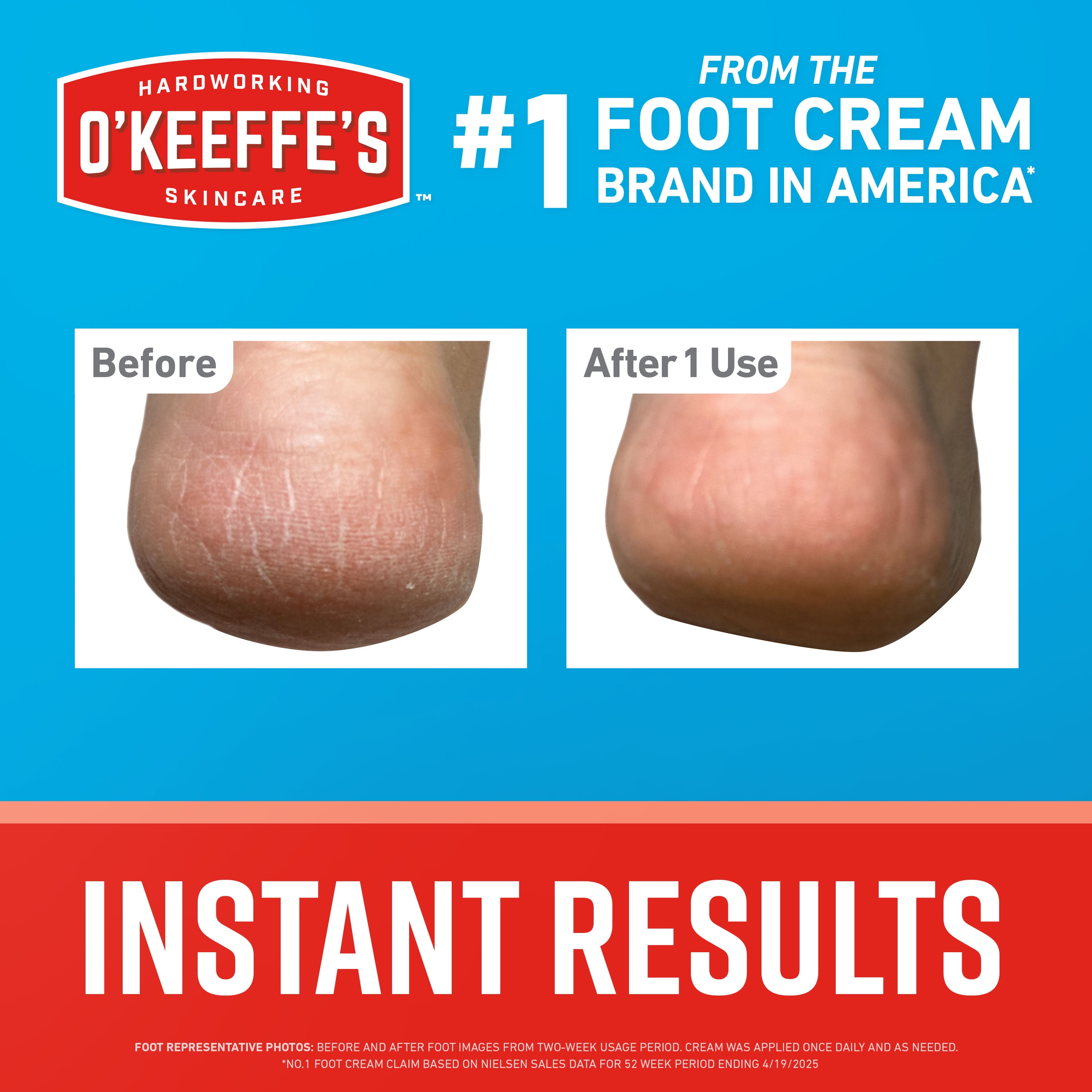O'Keeffe's Healthy Feet Pain Relieving Foot Cream with Lidocaine, 3oz Tube